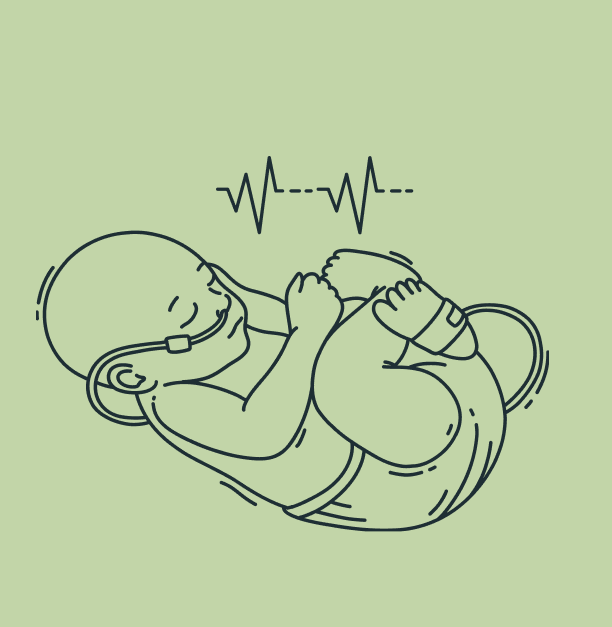 premature death due to no2