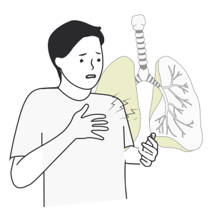 Pneumonite de hipersensibilidade devido a mofo